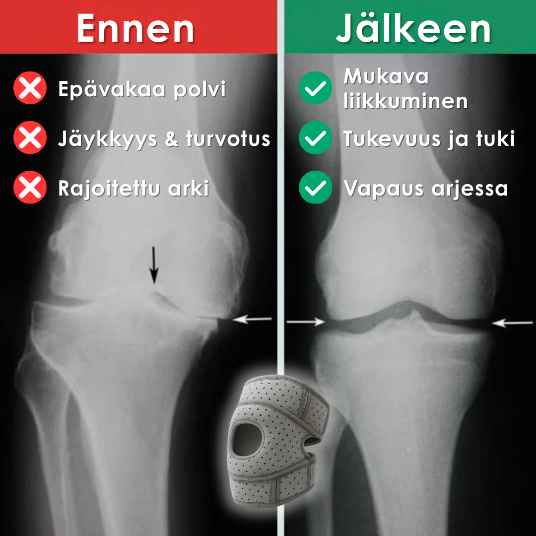 OrthoKnee Pro™ – Arkeen ilman polvikipuja